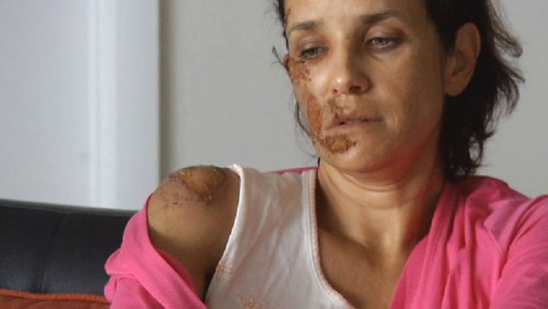 12 DE JULIO, 2012: Una turista brasileña por poco pierde la vida durante un robo en el estacionamiento de un Costco. <br /> Mira aquí todas las imágenes.<br />