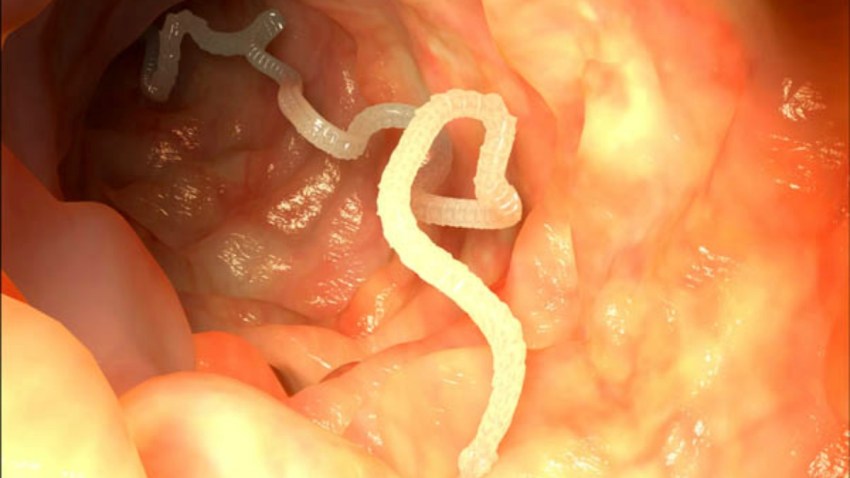 TLMD-parasito-solitaria-tenia-gusano-tapeworm-tenia-shutterstock_116330686