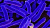 Alerta sanitaria: detectan bacteria E. coli en pozo de agua potable en Humble