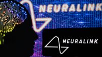 CNBC: la compañía de implantes cerebrales de Elon Musk, Neuralink, realizará primer estudio clínico en humanos