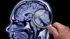 ¿Conoces a una persona con Alzheimer? Esto puede serle útil
