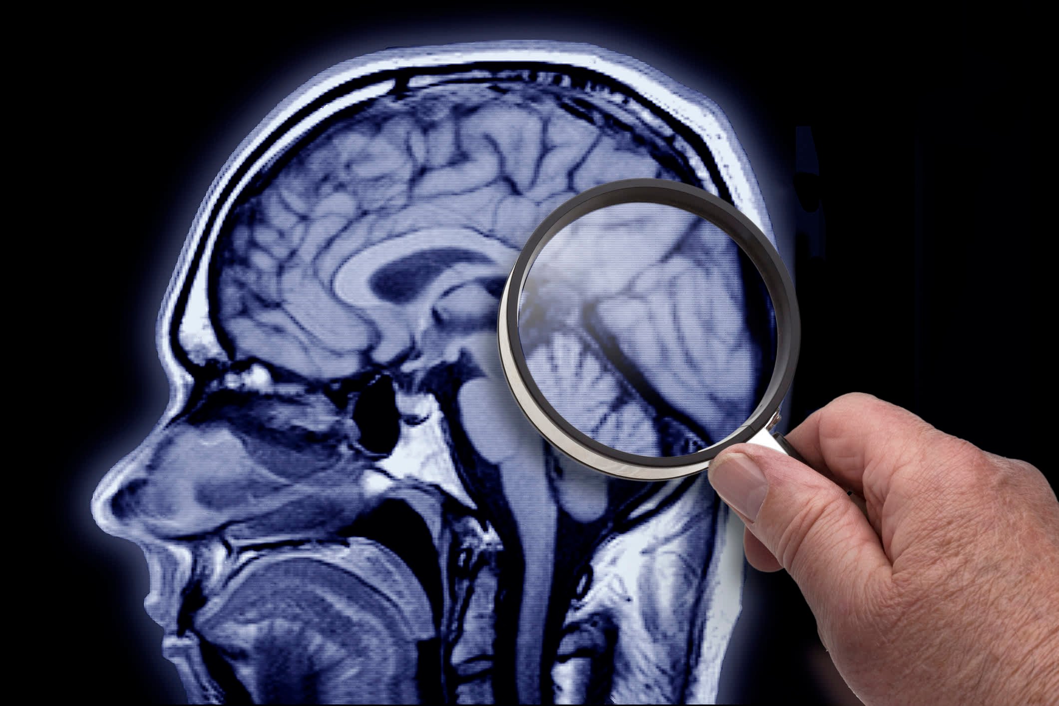 ¿Conoces a una persona con Alzheimer? Esto puede serle útil