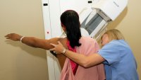 ¿Cuál es la edad recomendada para hacerse una mamografía? Panel emite nuevas directrices