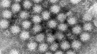 ARCHIVO – Esta imagen de microscopio electrónico facilitada por los Centros para el Control y la Prevención de Enfermedades de Estados Unidos (CDC, por sus siglas en inglés) muestra un grupo de viriones de norovirus. (Charles D. Humphrey/CDC vía AP, Archivo)